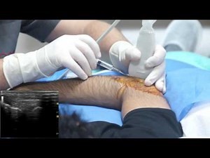 Ultrasound guided tennis elbow injection
